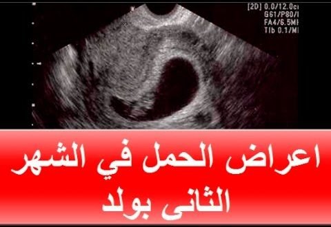 اعراض الحمل في الشهر الثاني بالولادة بموسوعة للمرأة العربية اعراض الحمل بالتفصيل